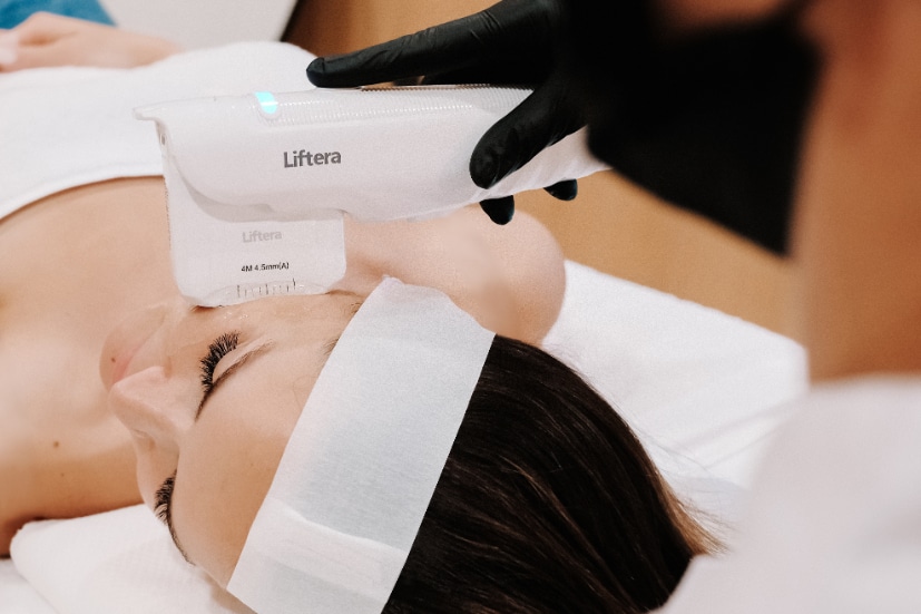 SMAS Lifting à Bruxelles – traitement non invasif par ultrasons dans un institut de beauté avec esthéticienne qualifiée à la technologie HIFU.