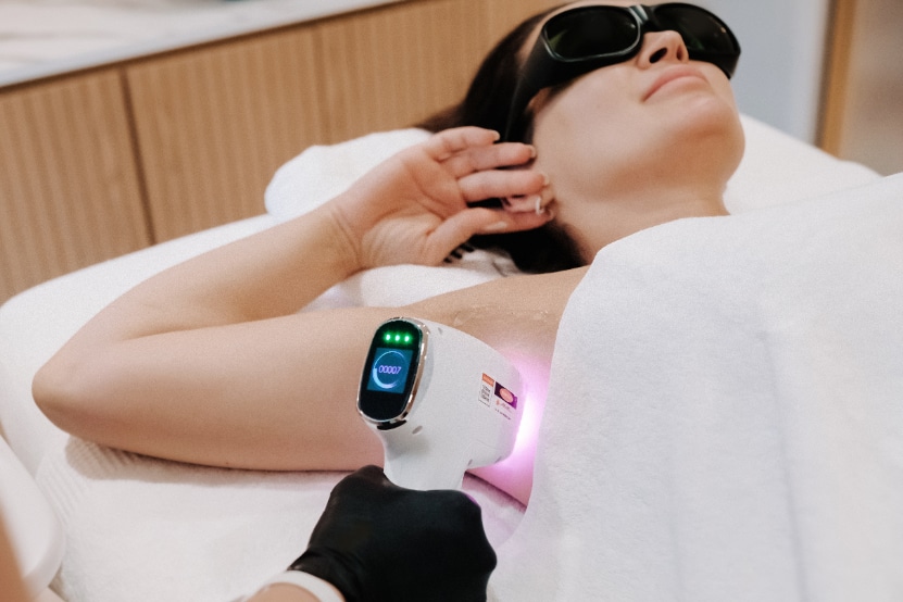 Épilation laser à Bruxelles dans un institut de beauté – solution durable avec une esthéticienne qualifiée