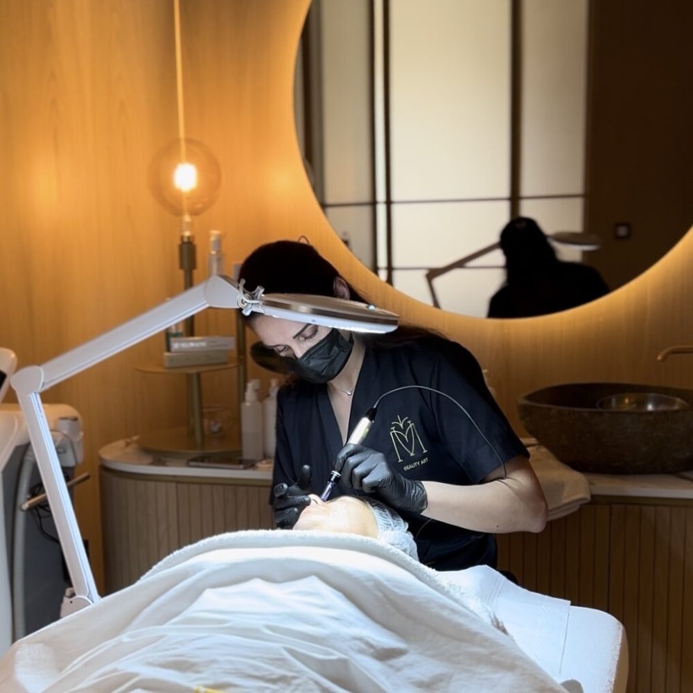 Close-up photograph of a professional Microneedling session at MV Beauty Art in Brussels, showing a precise dermal pen creating controlled micro-channels on a client's cheek to treat acne scars and stimulate collagen